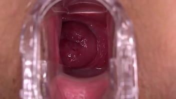 VAGINA CLOSEUP